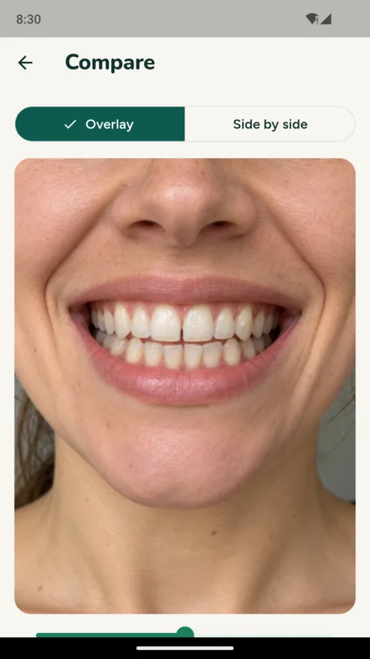 Compare: the latest front photo faded over the first one.