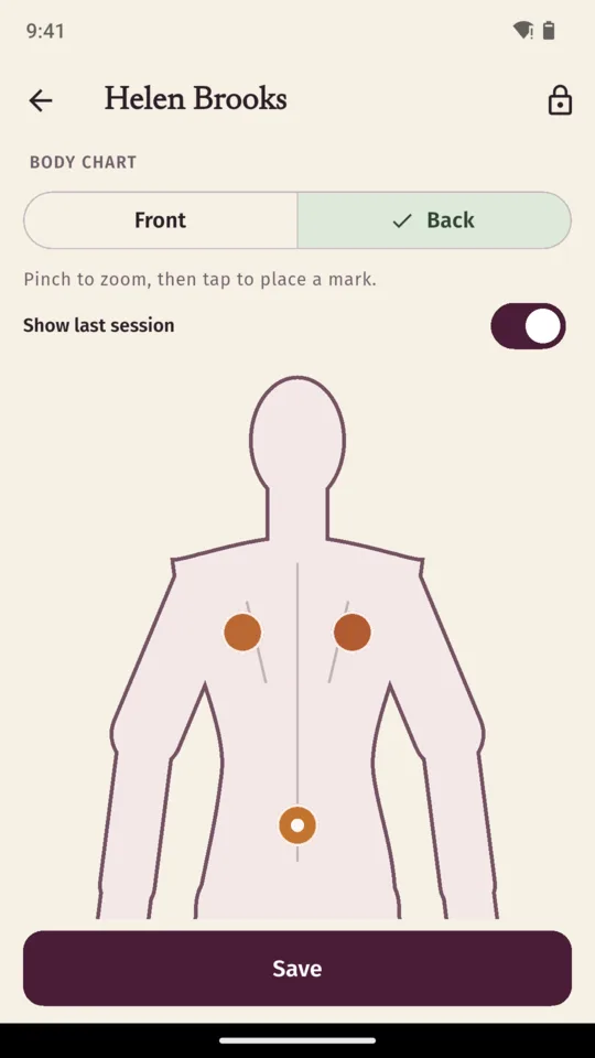 Helen Brooks’s body chart on the Back view, with two filled marks either side of the upper spine and a fainter ring lower down carried over from the previous session