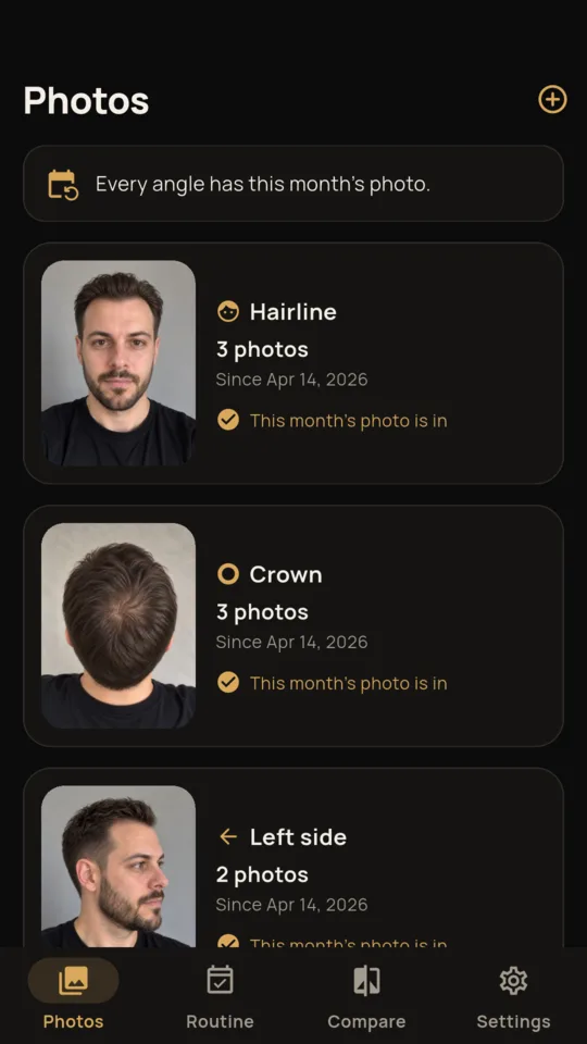 Photos: hairline, crown and left side, each with this month’s photo in.