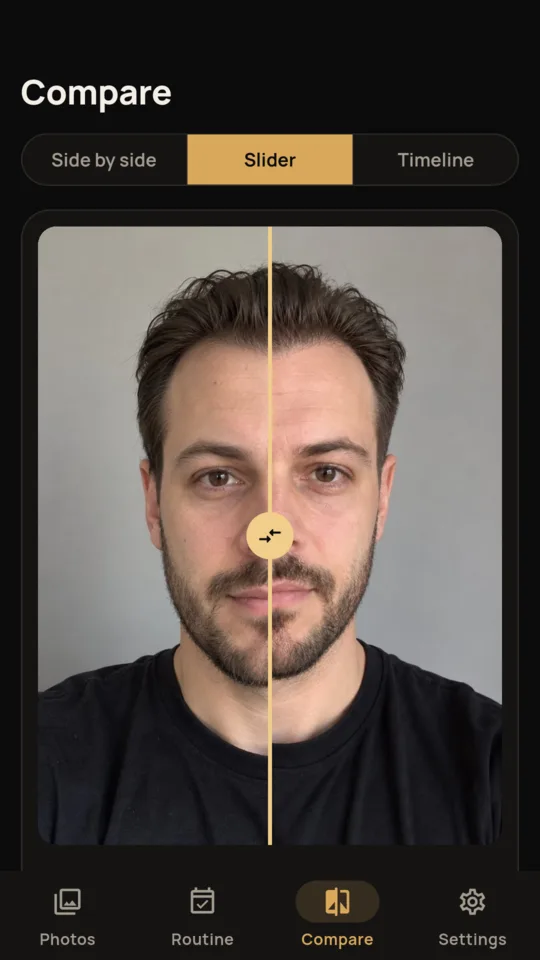 Slider: April and October hairline photos split by a line you drag