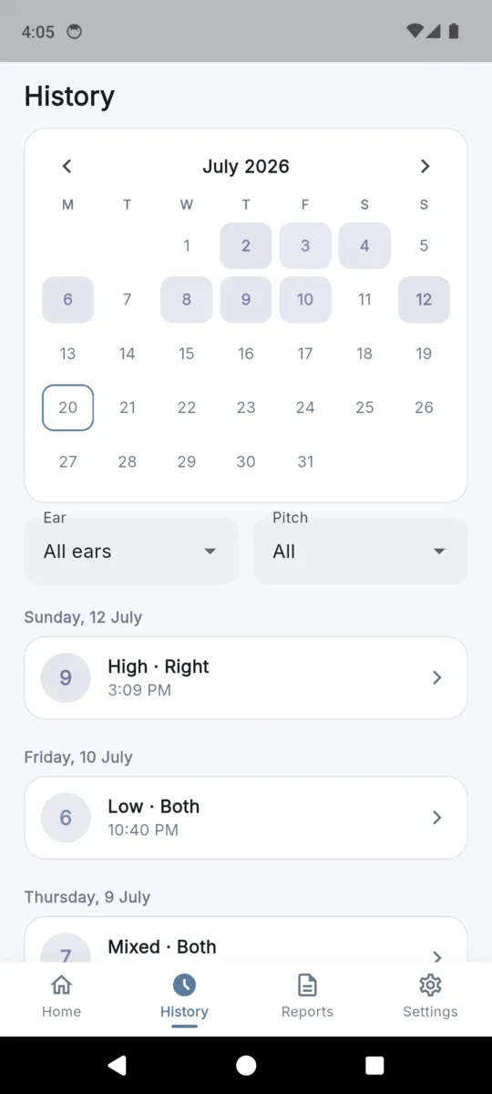 The TinnitusLog history screen with a month calendar, filters for ear and pitch, and dated spike entries grouped by day